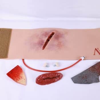 3 Element Wound with WoundLock