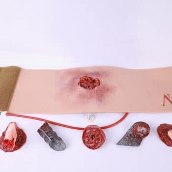 5 Element Wound with WoundLock
