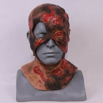 Burn Head Trauma Wound
